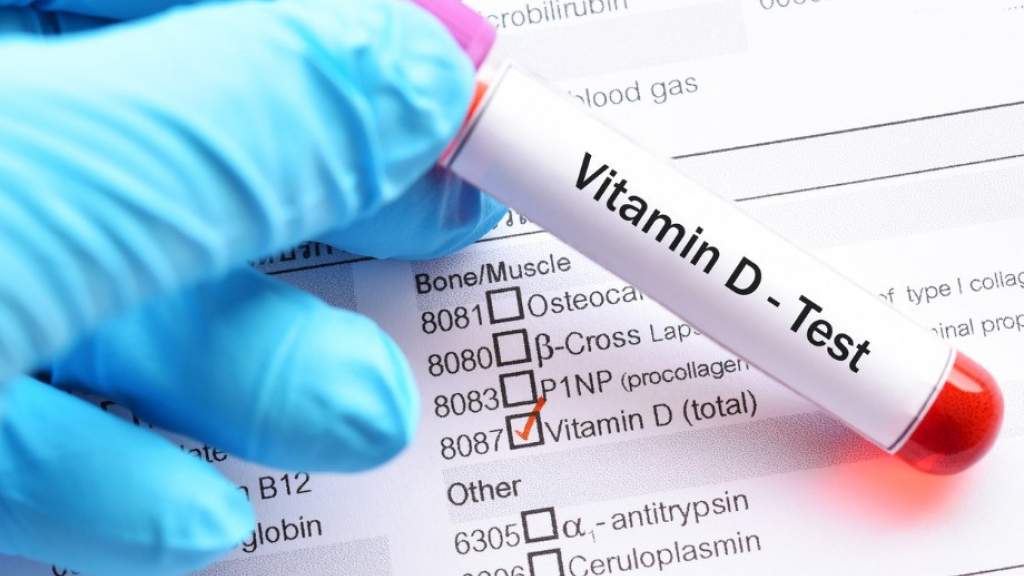 Где взять витамин D зимой? Как восполнить недостаток витамина D зимой?